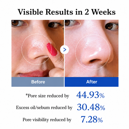 Zero Pore Pads