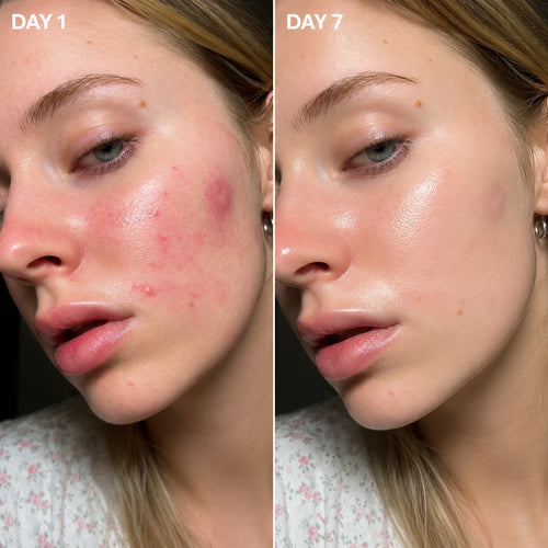 Centella® - Tone Brightening Capsule Ampoule
