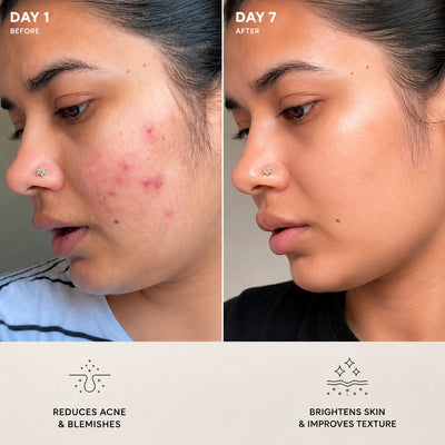 Centella® - Tone Brightening Capsule Ampoule