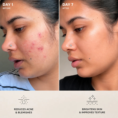 Centella® - Tone Brightening Capsule Ampoule