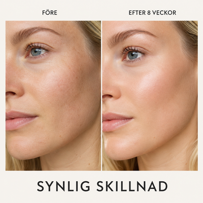 Essence Lift Pro — 6-i-1 LED & mikroströmsenhet